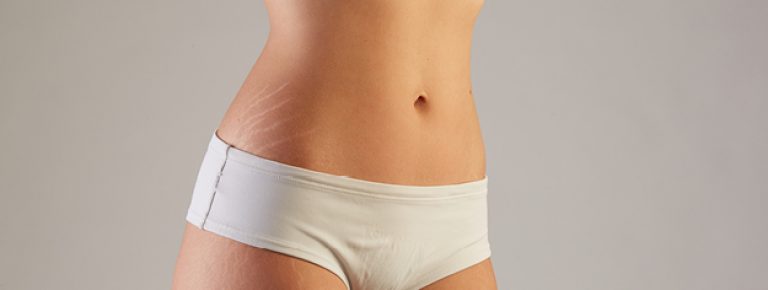 Lady's stomach