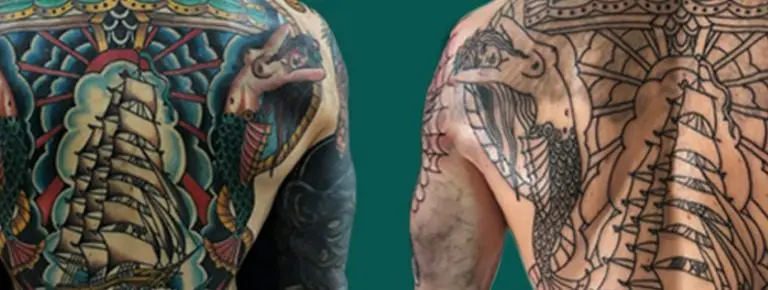 Tattoo Removal  Dermatology and Laser Centre of Los Angeles