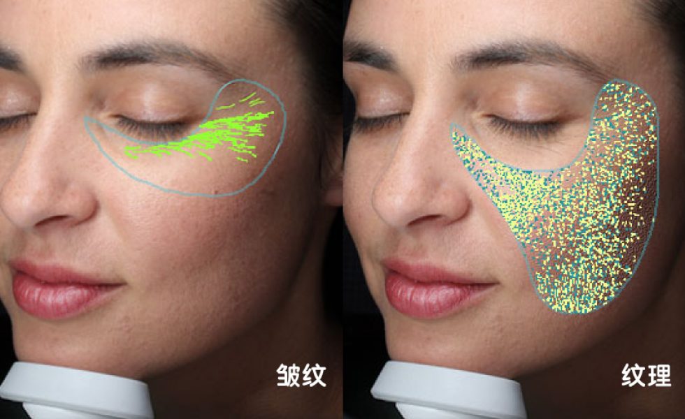 Before and after of ladies face showing illustrations of areas of skin issues