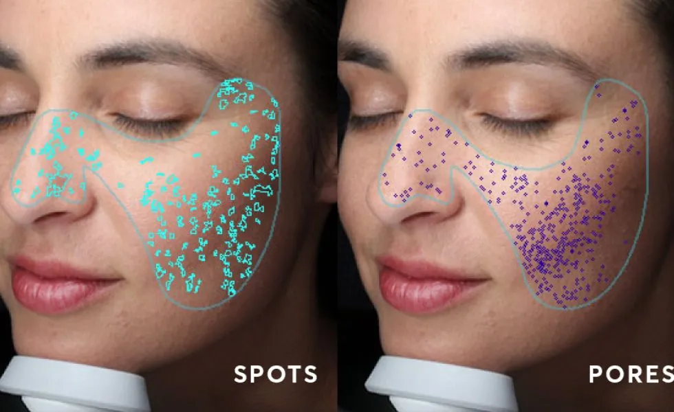 Before and after of ladies face showing illustrations of areas of skin issues