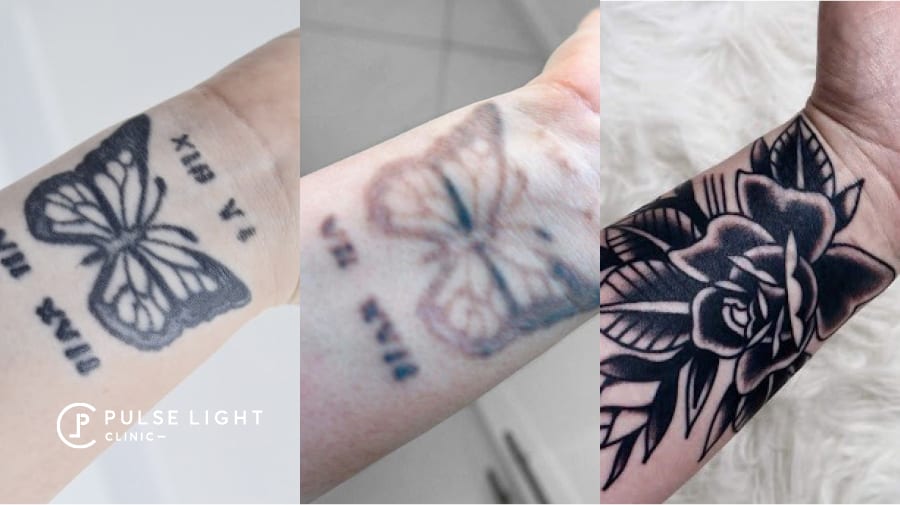 Tattoo Removal cover up display
