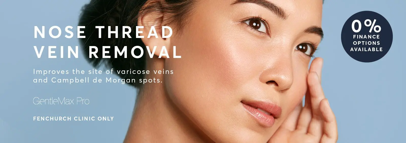 Nose vein removal london