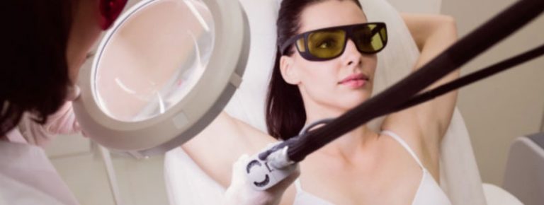 Laser hair removal side affects
