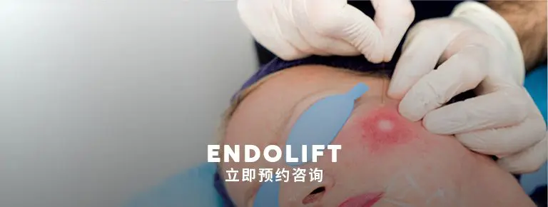 Pulse Light Clinic Endolift London