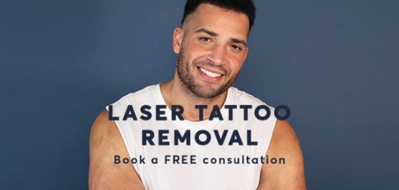 Laser Tattoo Removal James real people true results 2024