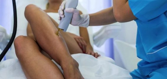 Can Laser Hair Removal Stop Working?