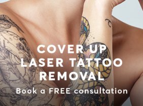 Tattoo Removal Cover Ups London Mobile
