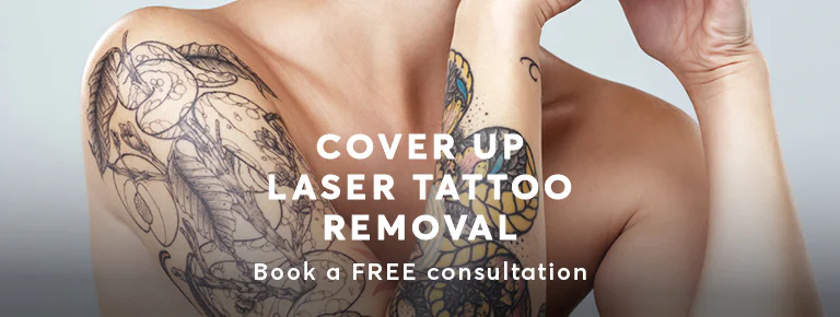 Tattoo Removal Cover Ups London Mobile
