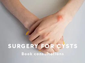 Cyst Removal Dermatology